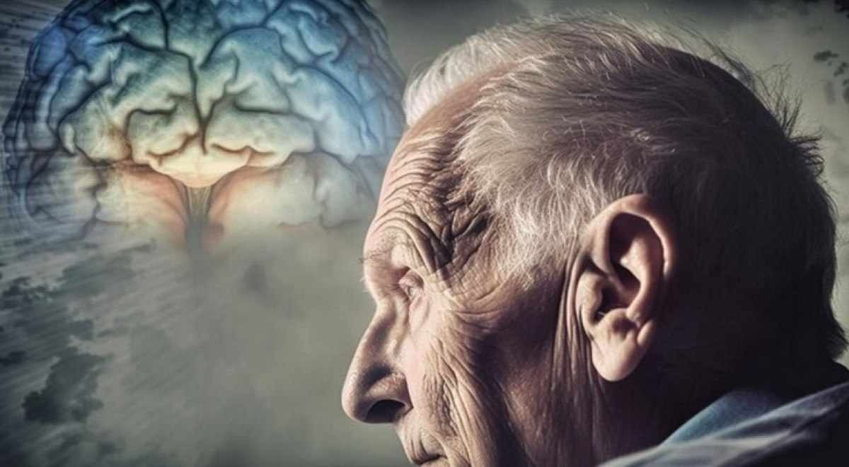 Alzheimer é responsável por cerca de 60% dos casos de demência -  (crédito: Freepik)