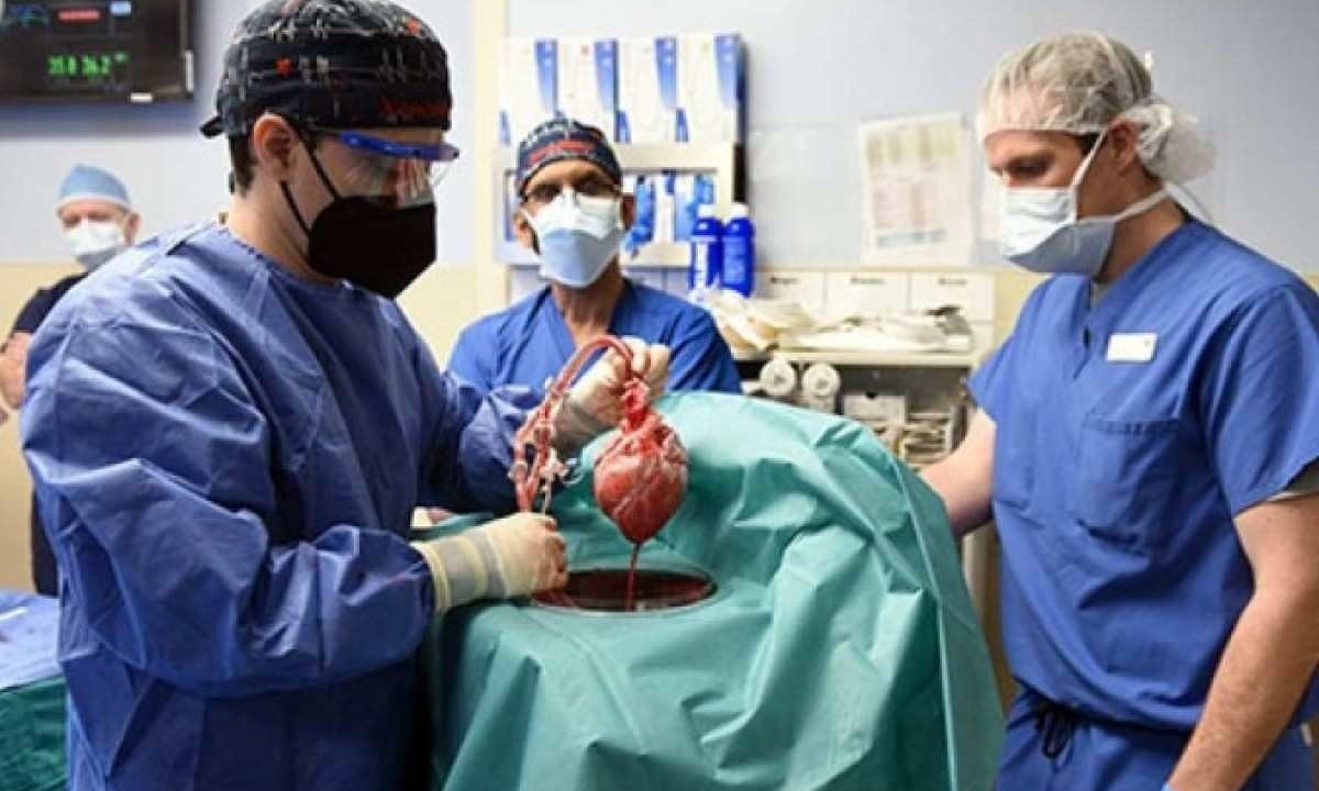 Médicos com um coração de porco durante cirurgia -  (crédito: Escola de Medicina da Universidade de Maryland)