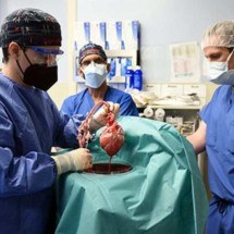 Cientistas obtêm respostas para rejeições em transplantes de órgãos - Escola de Medicina da Universidade de Maryland