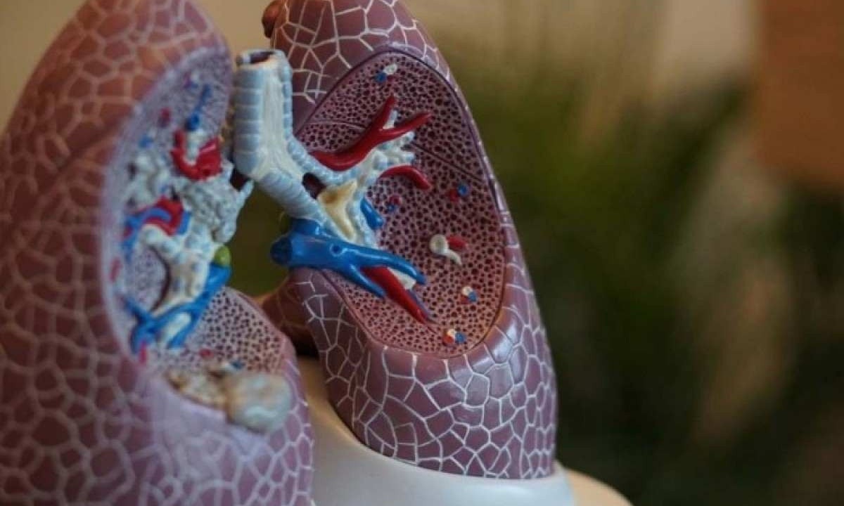 Pneumonite é uma inflamação dos tecidos pulmonares, entre elas estão: alergias, exposição a certos produtos químicos e outros -  (crédito:  Unsplash/ Robina Weermeijer)
