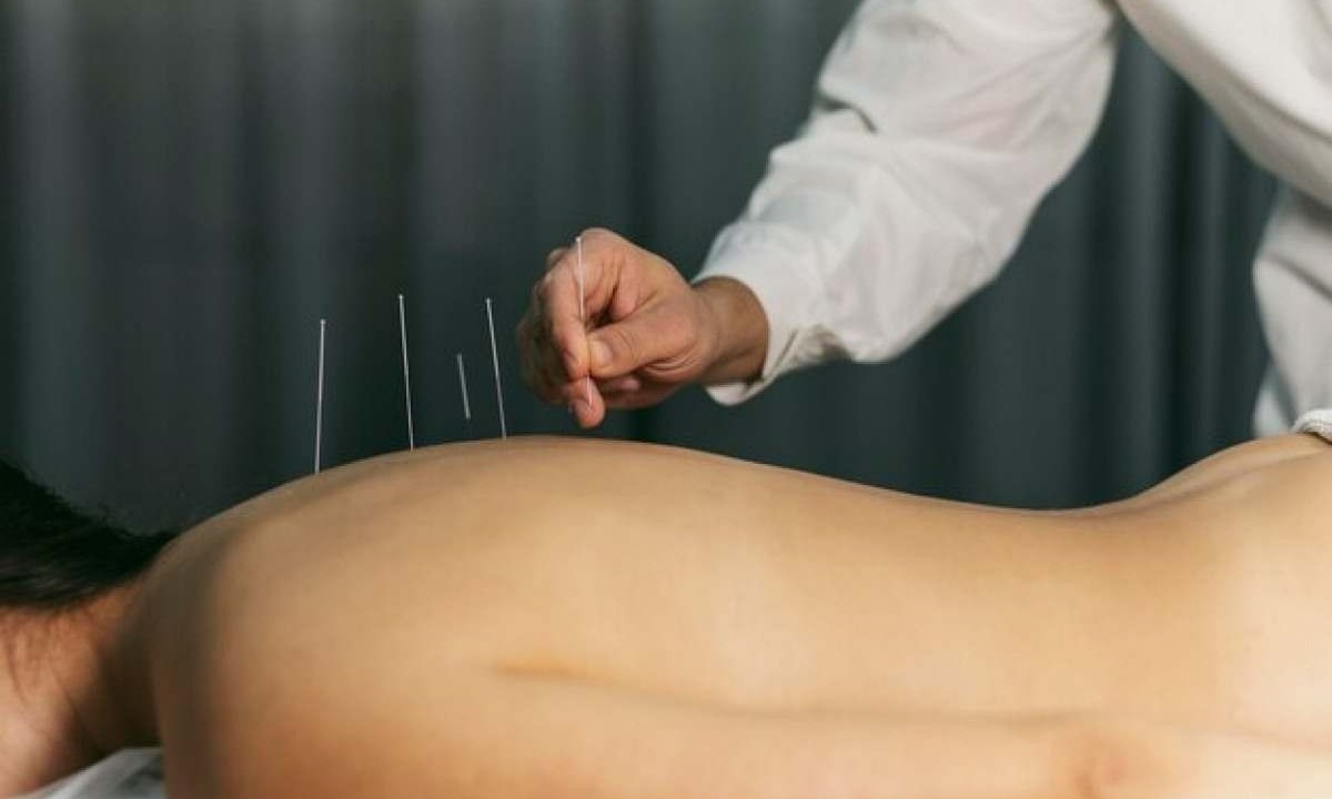 Hoje, entende-se que acupuntura tem importante atuação no sistema nervoso central e como o mesmo gera uma resposta para os tecidos -  (crédito: Freepik)