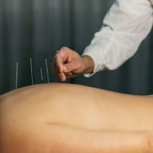 Como a acupuntura pode ajudar a lidar com a ansiedade? - Freepik