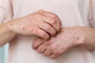 Doença 'dos mais velhos' está atacando jovens; saiba se você corre risco