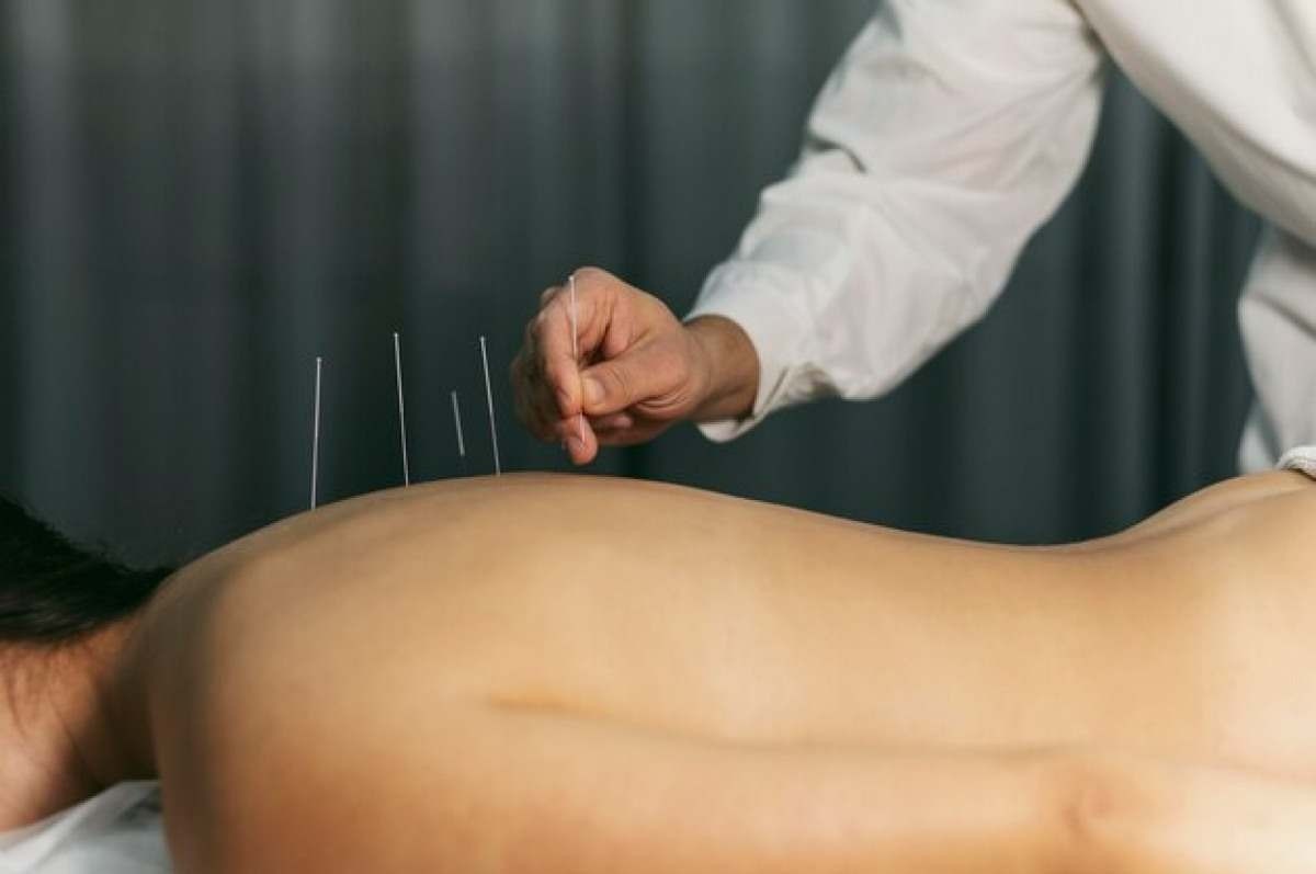 Como a acupuntura pode ajudar a lidar com a ansiedade?