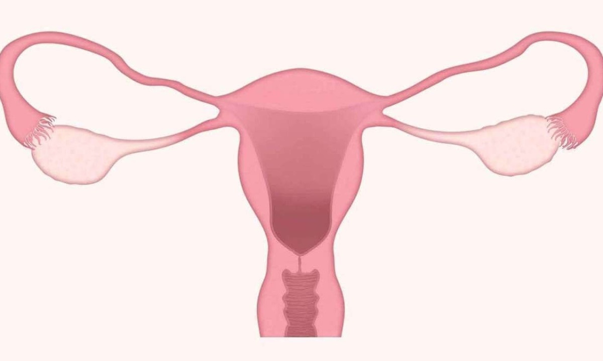  Tanto a adenomiose quanto o teratoma impactam a saúde da mulher se não forem tratados corretamente -  (crédito: PIXABAY/REPRODUÇÃO)