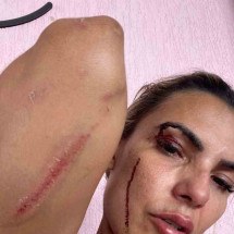 Vídeo mostra mulher sendo agredida pelo ex-companheiro - Material cedido ao Correio 