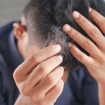 Dengue causa queda de cabelo? Entenda o motivo e como se recuperar - Towfiqu barbhuiya/Unsplash