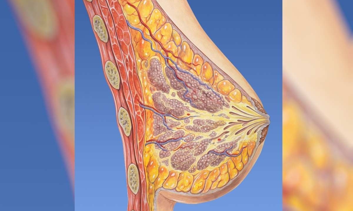 Ilustração de câncer de mama -  (crédito: Creative Commons Attribution 2.5 License 2006; Patrick J. Lynch, medical illustrator; C. Carl Jaffe, MD, cardiologist)