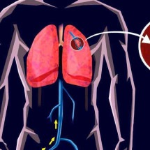 Evite a embolia pulmonar que ocorre durante as viagens de avião - Fabio Rossi/reprodução