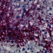 Bactéria oral pode influenciar câncer colorretal, aponta estudo - Fred Hutchinson Cancer Center/Divulgação