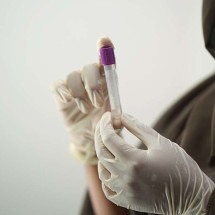 Exame de sangue detecta precocemente câncer colorretal - Shameersrk/Pixabay