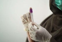 Exame de sangue detecta precocemente câncer colorretal