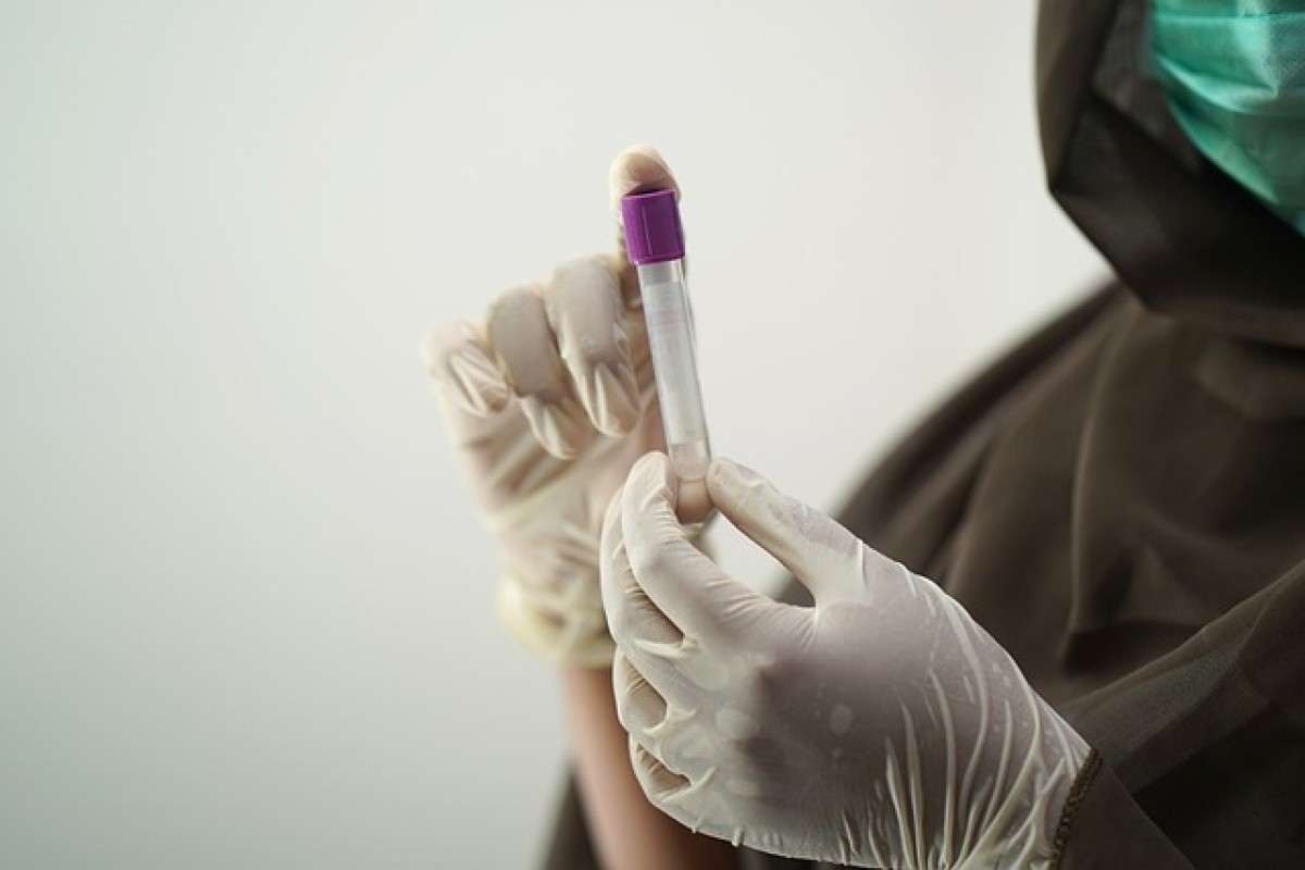 Exame de sangue detecta precocemente câncer colorretal