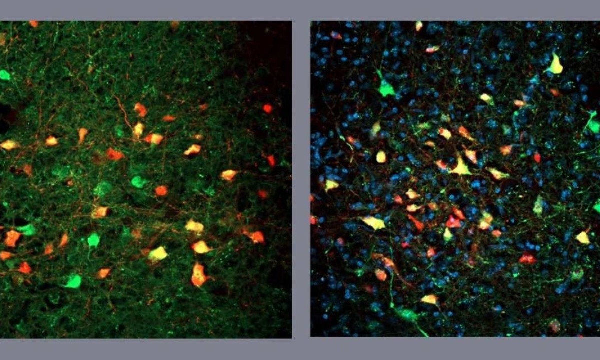 Células VGAT da substância cinzenta periaquedutal em verde e em amarelo. As células vermelhas fazem contatos sinápticos em neurônios VGAT
 -  (crédito: Acervo Pesquisadores/Diuvlgação)