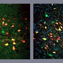 Neurônios deflagram busca frenética por alimentos, mesmos em fome - Acervo Pesquisadores/Diuvlgação