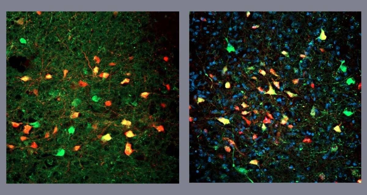 Neurônios deflagram busca frenética por alimentos, mesmos em fome
