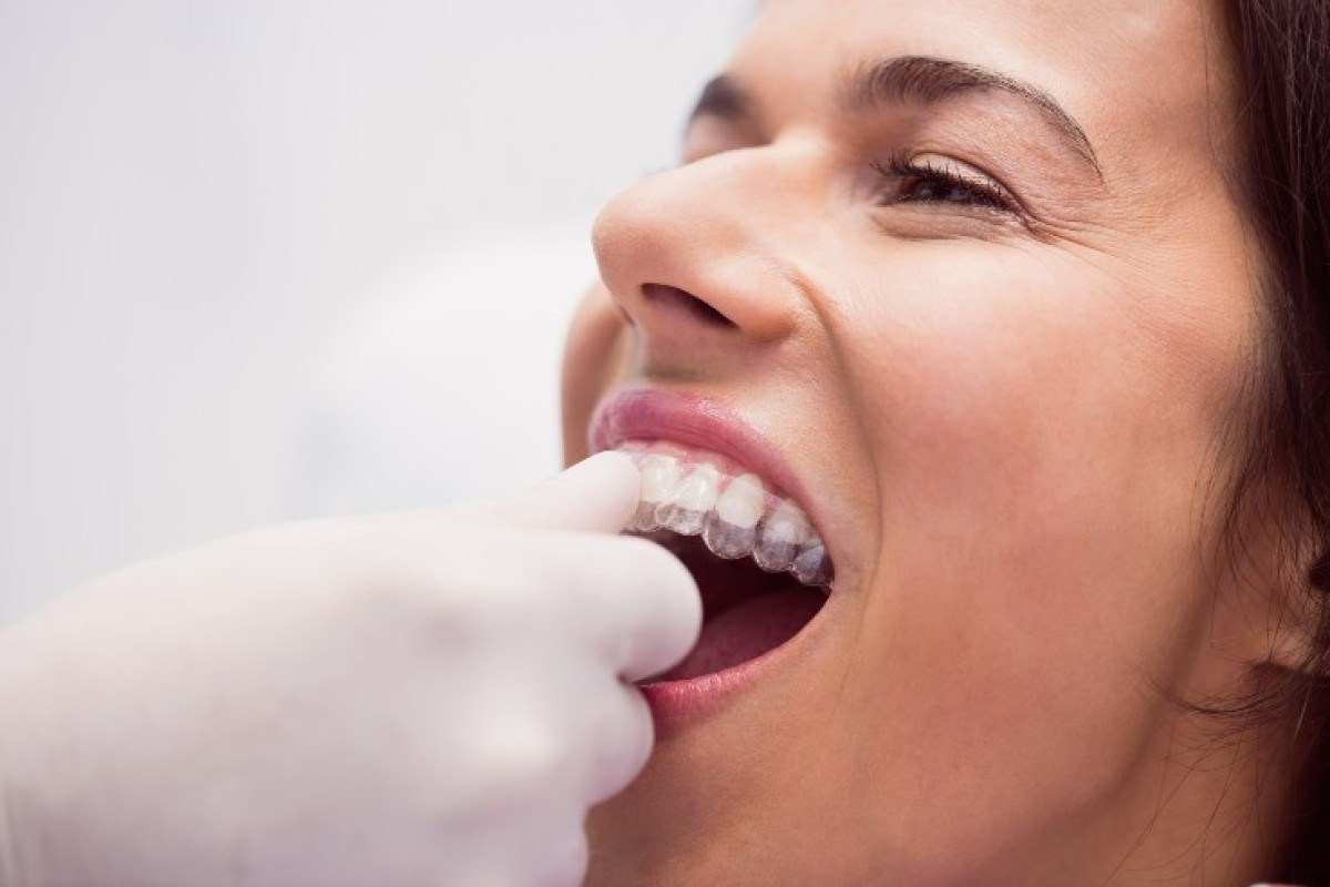 Conheça 7 sinais de que você precisa usar aparelho ortodôntico
