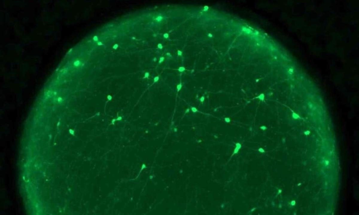 Imagem mostra os organoides com neurônios (marcados em verde) -  (crédito:  Joshua Berlind/Laboratório Ichida)