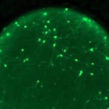 Entenda como lesões cerebrais podem prevenir doenças neurodegenerativas -  Joshua Berlind/Laboratório Ichida
