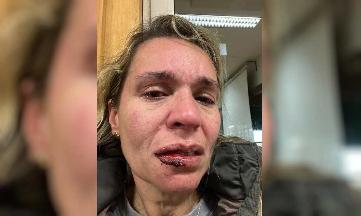 Brasileira Grazielle Tavares levou um soco na boca que a deixou ferida; ela também levou um chute na barriga  -  (crédito: Arquivo pessoal)