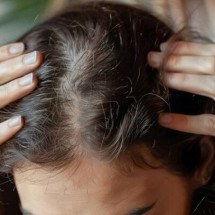 Sete verdades sobre a importância de cuidar do couro cabeludo - Freepik