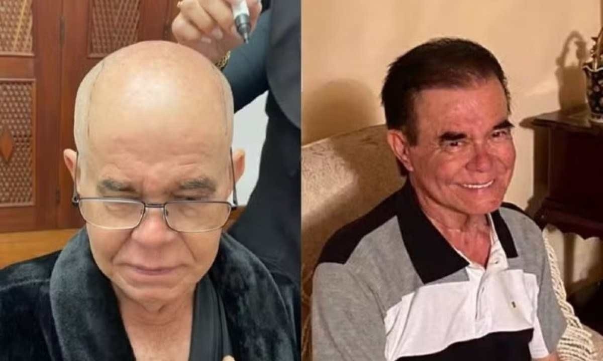  Bernardino Coelho, de 80 anos, tomou a decisão pelo transplante depois da pandemia para ter uma 'melhor versão' de si mesmo -  (crédito: Centro Médico Capilar (CMC)/Divulgação)
