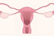 O câncer de ovário e seus sintomas (parte 1)