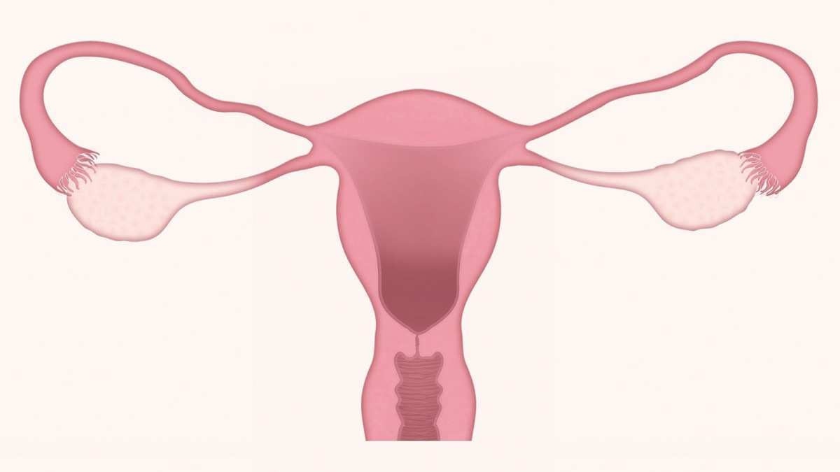 O câncer de ovário e seus sintomas (parte 1)