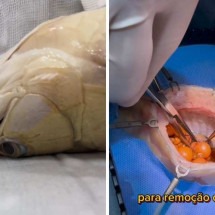 Vídeo de cirurgia em peixe viraliza na web - Reprodução / Instagram / Luiz Guaraná