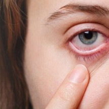 Síndrome do Olho Seco e o uso das telas: qual a relação? - Freepik