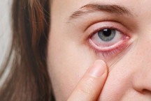 Síndrome do Olho Seco e o uso das telas: qual a relação?