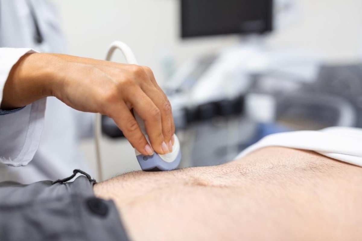 25% dos sarcomas, tipos raros do câncer, são diagnosticados incorretamente