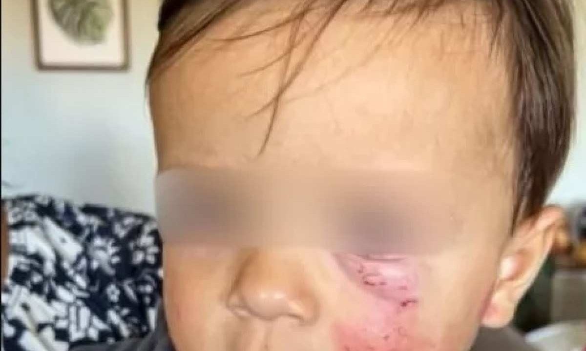 Bebê sofre queimaduras durante banho em creche de SC
 -  (crédito: Reprodução/ Arquivo pessoal)