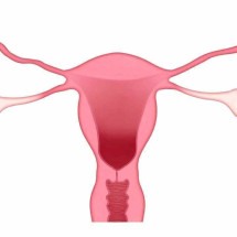 O câncer de ovário e seus sintomas (parte 2) - LJNovaScotia/Pixabay