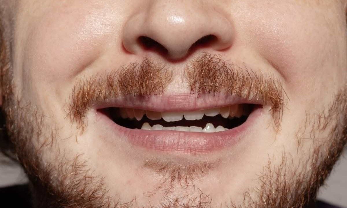 Para combater o envelhecimento dental precoce e manter a saúde bucal ao longo da vida, são recomendadas práticas de higiene bucal adequadas -  (crédito: Freepik)