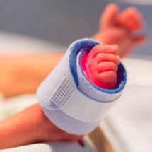 Os cuidados com os bebês prematuros. Veja o que fazer