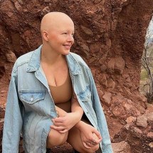 Morre tiktoker que compartilhou luta contra câncer terminal - Reprodução/Instagram/@fruitsnackmaddy (6/2/2024)