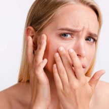 Celulite no rosto? Entenda como a infecção bacteriana traz riscos à saúde - Freepik