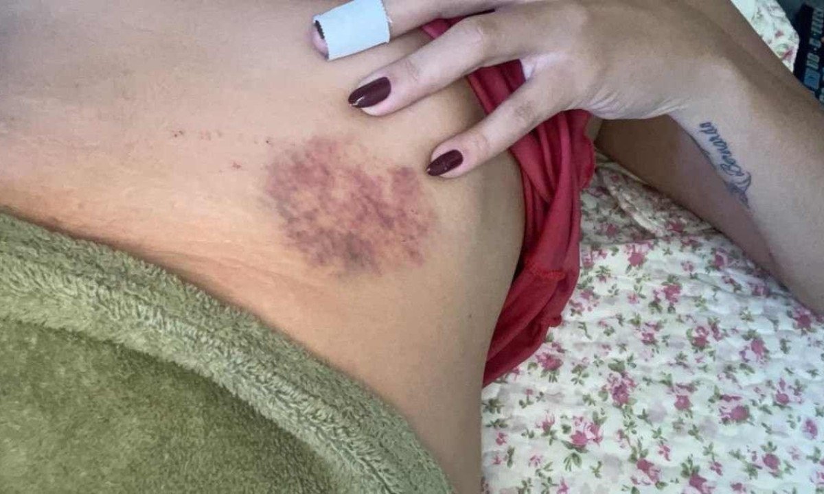 Vítima sofreu ferimentos da região do abdômen  -  (crédito: Arquivo Pessoal )