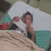 Menino de 12 anos mordido por jacaré na Cidade de Deus está internado - Reprodução / Redes Sociais