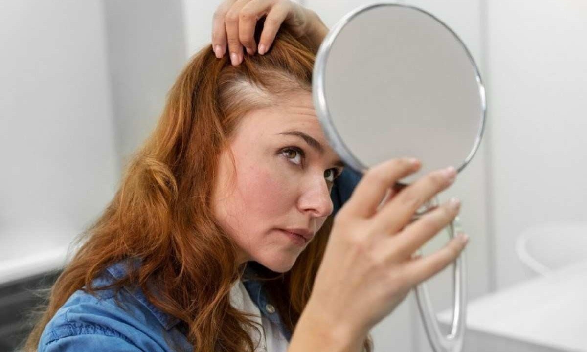 A queda de cabelo é um problema comum entre as mulheres: cerca de 40% sofrem com a condição em algum momento da vida -  (crédito: Freepik)
