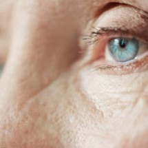 Glaucoma é a maior causa de cegueira entre os brasileiros - Freepik