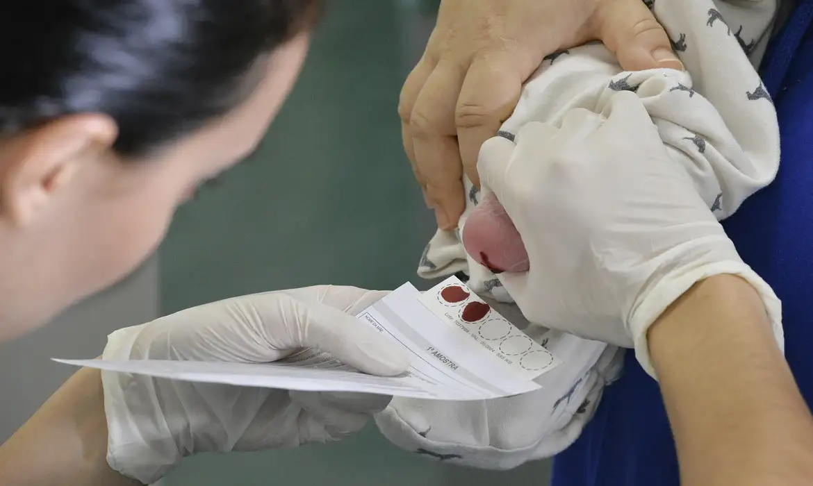 Médicos chamam atenção para mucopolissacaridose, doença genética rara - EBC - Saúde