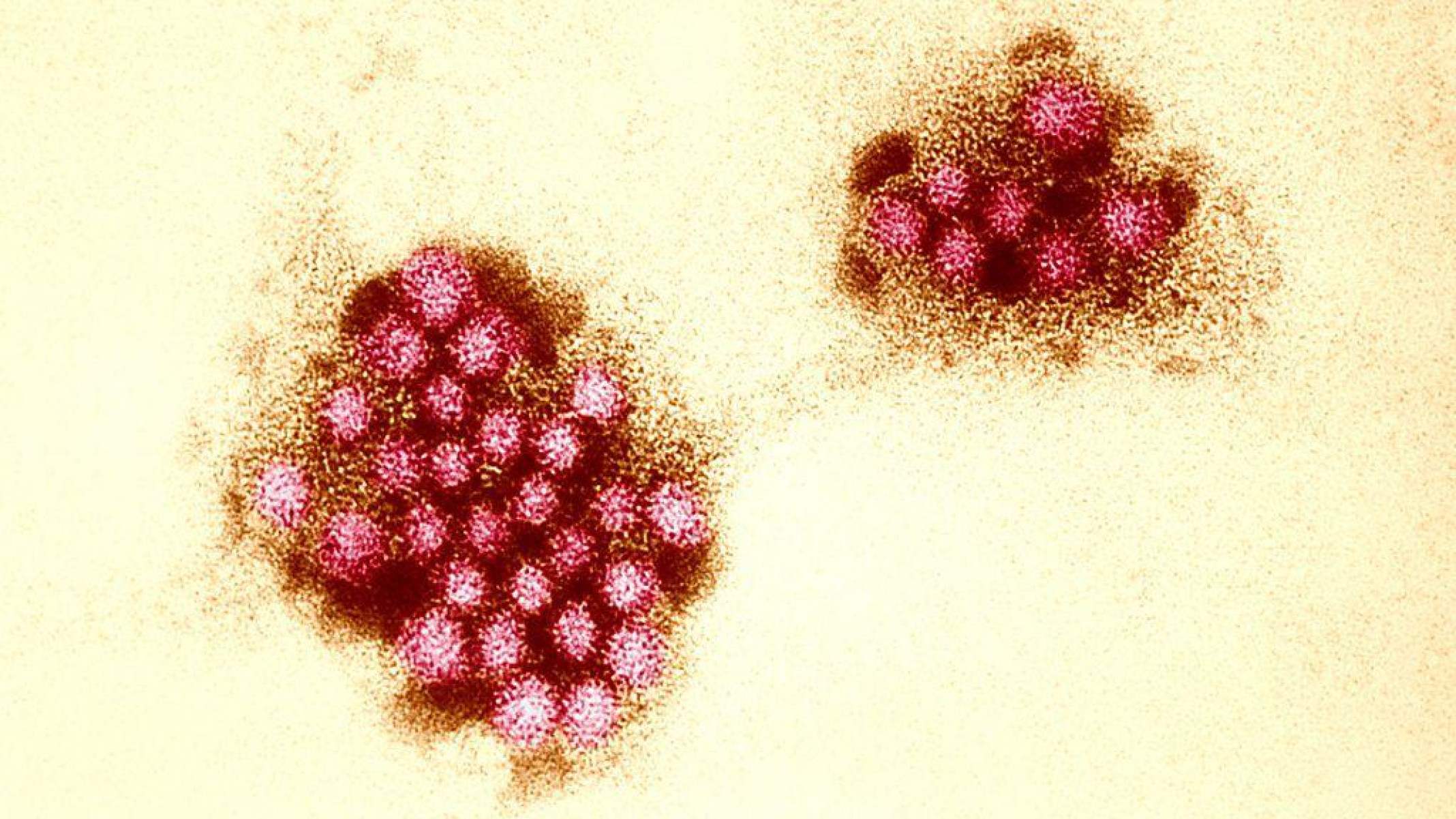 O acaso genético que protege alguns do 'vírus do vômito' e pode ajudar a desenvolver vacina