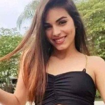 Jovem atacada com soda cáustica tem alta da UTI, mas segue internada no PR - Reprodução/Instagram