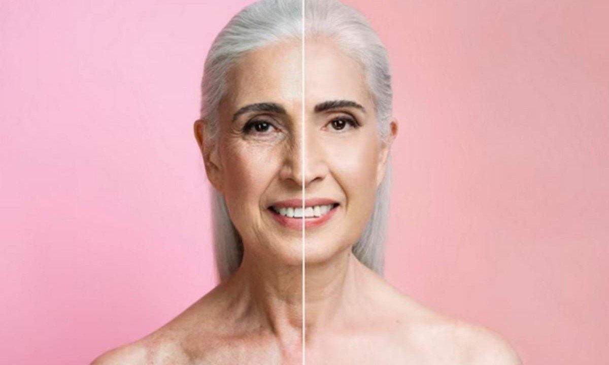Focar apenas no colágeno na tentativa de combater o envelhecimento facial pode gerar frustração com os resultados, pois essa não é a única estrutura afetada pelo envelhecimento -  (crédito: Freepik)