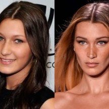 Nariz arrebitado: entenda por que a rinoplastia atual foge desse padrão - Reprodução