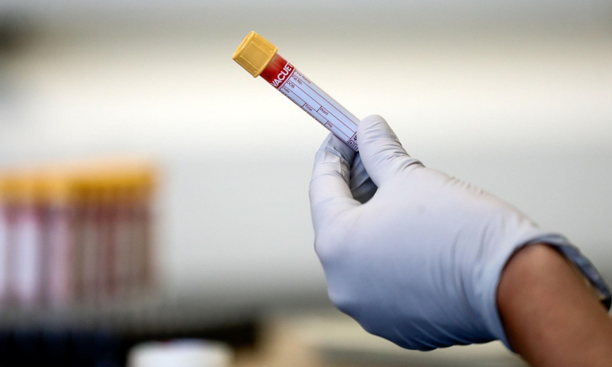 Os exames de sangue fornecem aos médicos mais informações para orientar diagnósticos e decisões de tratamento -  (crédito: Reuters)