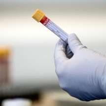 Como interpretar um exame de sangue?  - Reuters