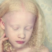Basta de preconceito: precisamos falar sobre pessoas albinas -  Credito Gustavo Lacerda/Divulga&ccedil;&atilde;o
